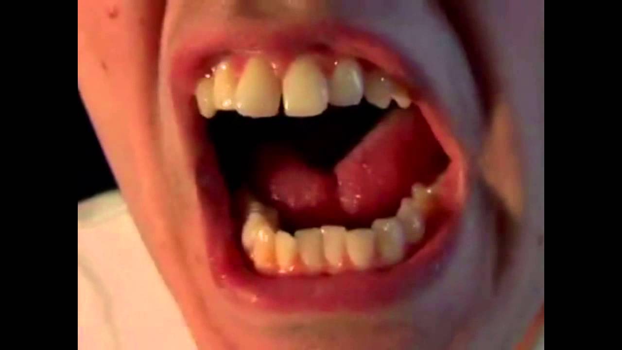 First AVGN YTPMV of 2015???